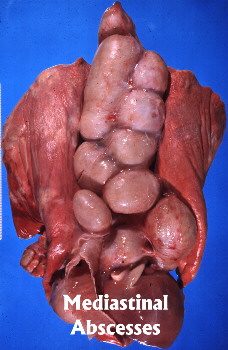 Mediastinal Abscesses